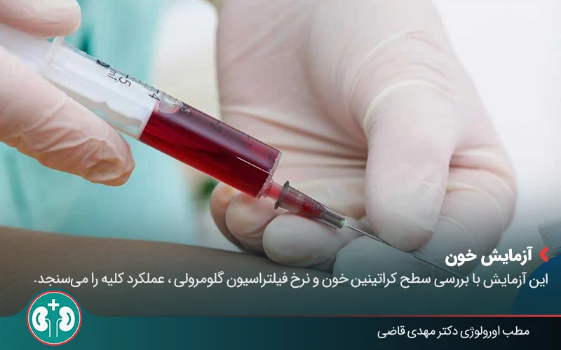 renal atrophy 08