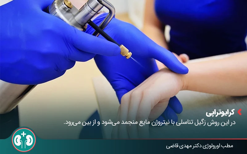 genital warts treatment garlic 03